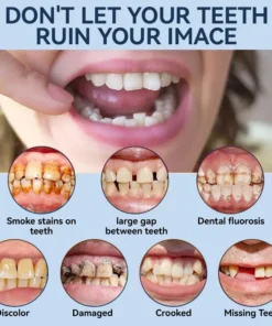 SmileFitPro® – 𝐌𝐞𝐝𝐢𝐜𝐚𝐥𝐅𝐢𝐭 𝐀𝐝𝐚𝐩𝐭𝐢𝐯𝐞 𝐃𝐞𝐧𝐭𝐮𝐫𝐞𝐬