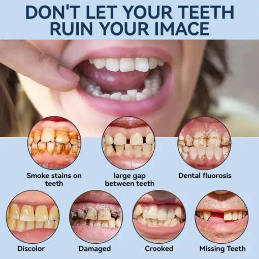 SmileFitPro® – 𝐌𝐞𝐝𝐢𝐜𝐚𝐥𝐅𝐢𝐭 𝐀𝐝𝐚𝐩𝐭𝐢𝐯𝐞 𝐃𝐞𝐧𝐭𝐮𝐫𝐞𝐬