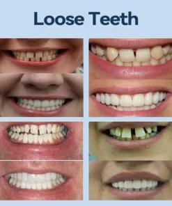 SmileFitPro® – 𝐌𝐞𝐝𝐢𝐜𝐚𝐥𝐅𝐢𝐭 𝐀𝐝𝐚𝐩𝐭𝐢𝐯𝐞 𝐃𝐞𝐧𝐭𝐮𝐫𝐞𝐬