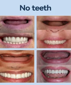 SmileFitPro® – 𝐌𝐞𝐝𝐢𝐜𝐚𝐥𝐅𝐢𝐭 𝐀𝐝𝐚𝐩𝐭𝐢𝐯𝐞 𝐃𝐞𝐧𝐭𝐮𝐫𝐞𝐬