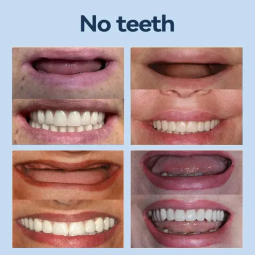 SmileFitPro® – 𝐌𝐞𝐝𝐢𝐜𝐚𝐥𝐅𝐢𝐭 𝐀𝐝𝐚𝐩𝐭𝐢𝐯𝐞 𝐃𝐞𝐧𝐭𝐮𝐫𝐞𝐬