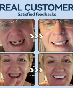 SmileFitPro® – 𝐌𝐞𝐝𝐢𝐜𝐚𝐥𝐅𝐢𝐭 𝐀𝐝𝐚𝐩𝐭𝐢𝐯𝐞 𝐃𝐞𝐧𝐭𝐮𝐫𝐞𝐬