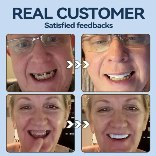 SmileFitPro® – 𝐌𝐞𝐝𝐢𝐜𝐚𝐥𝐅𝐢𝐭 𝐀𝐝𝐚𝐩𝐭𝐢𝐯𝐞 𝐃𝐞𝐧𝐭𝐮𝐫𝐞𝐬