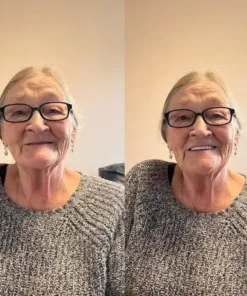 SmileFitPro® BioFusion Dentures
