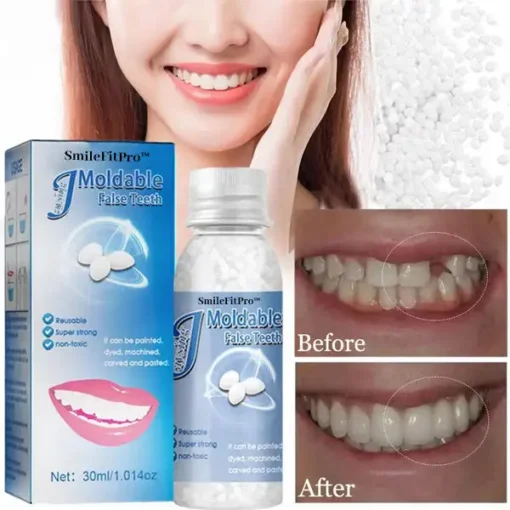 SmileFitPro™ Dental Filling Gel – Pain-Free, Drill-Free Cavity Solution