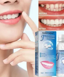 SmileFitPro™ Dental Filling Gel – Pain-Free, Drill-Free Cavity Solution