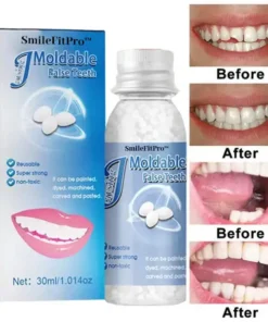 SmileFitPro™ Dental Filling Gel – Pain-Free, Drill-Free Cavity Solution