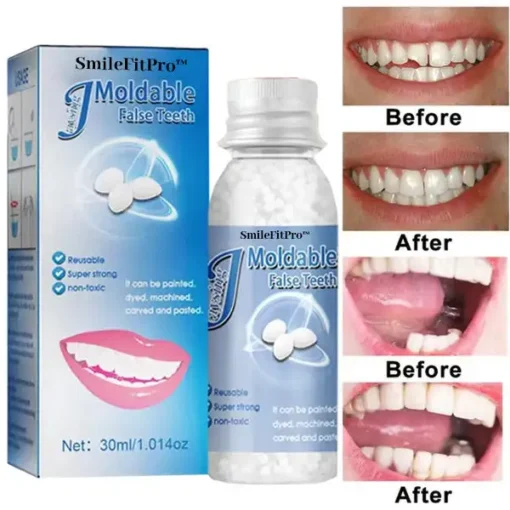 SmileFitPro™ Dental Filling Gel – Pain-Free, Drill-Free Cavity Solution
