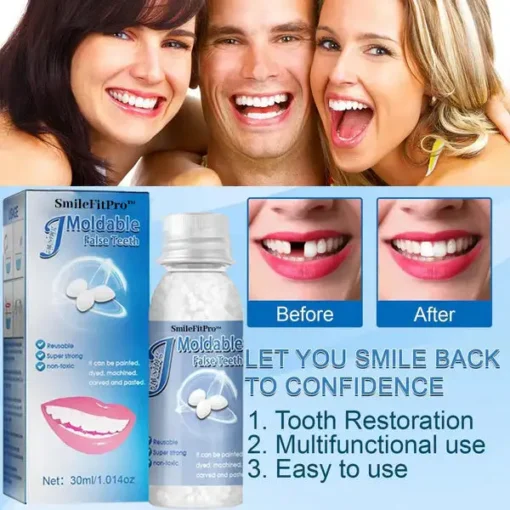 SmileFitPro™ Dental Filling Gel – Pain-Free, Drill-Free Cavity Solution