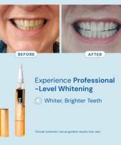 SmileFitPro™ Extra-Strength Teeth Whitening Serum Pen + Dual-Peroxide Formula & Xylitol