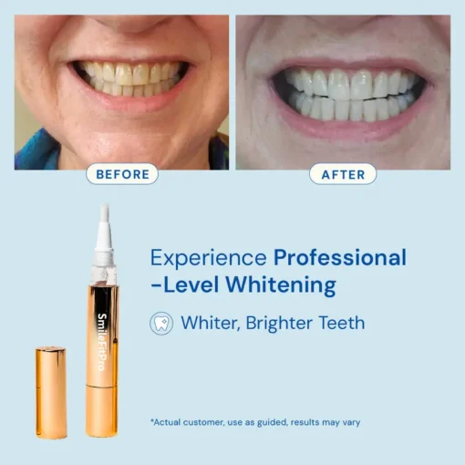 SmileFitPro™ Extra-Strength Teeth Whitening Serum Pen + Dual-Peroxide Formula & Xylitol